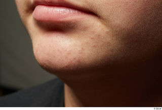  HD Face skin references Abraham Hurtado lips mouth nose skin pores skin texture 0005.jpg